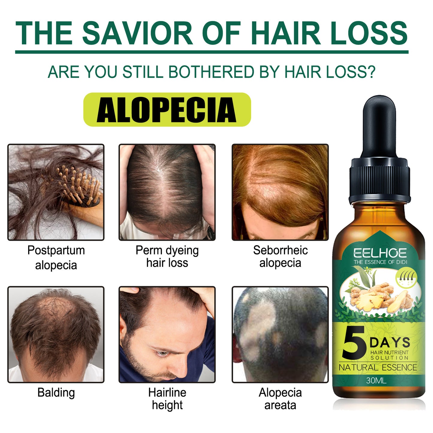 [vendor] Eelhoe Ginger Hair Essential Oil. Eelhoe Ginger Hair