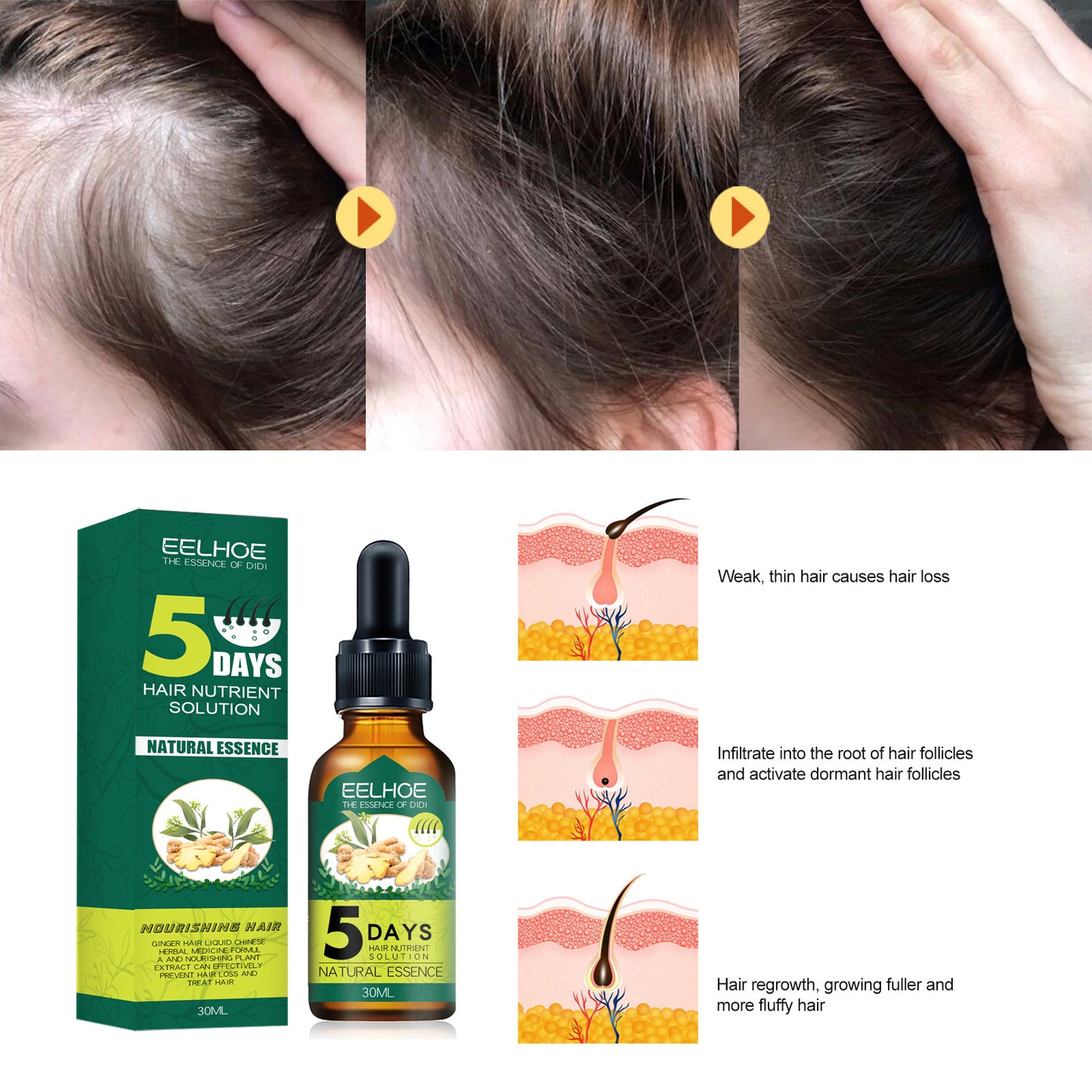 [vendor] Eelhoe Ginger Hair Essential Oil. Eelhoe Ginger Hair