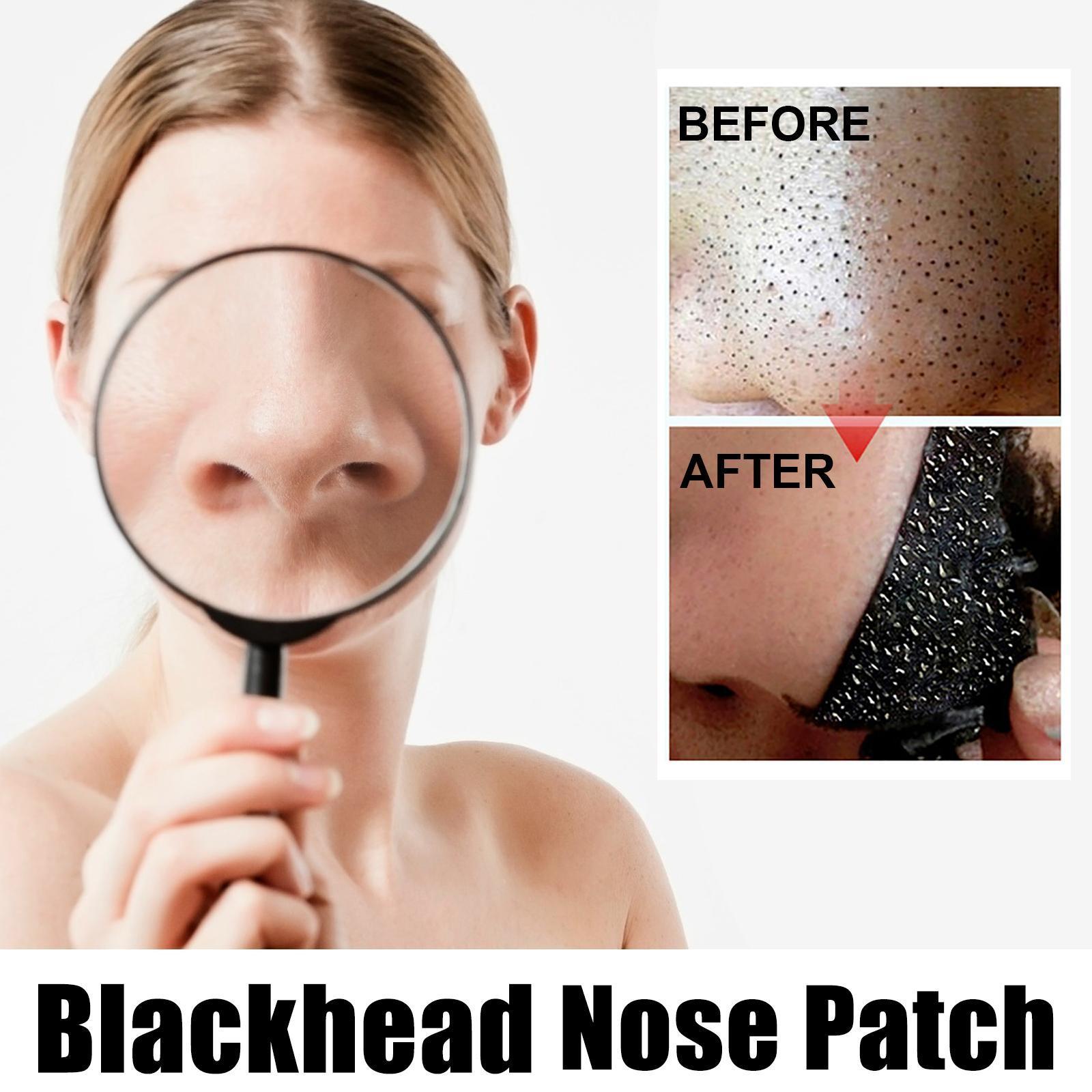 [vendor] 10 Pcs Blackhead Nose Patch Nose Pore Cleansing Strips