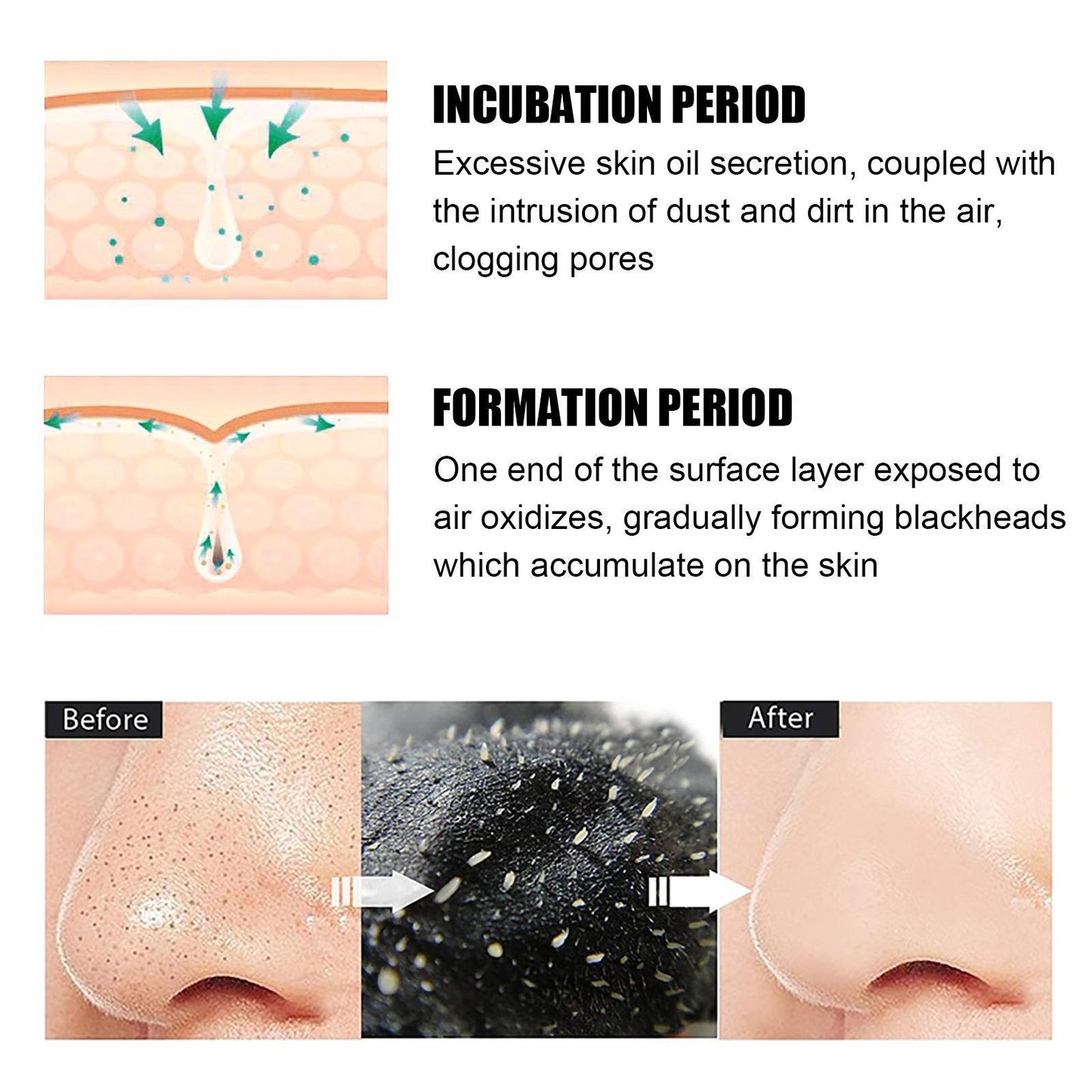 [vendor] 10 Pcs Blackhead Nose Patch Nose Pore Cleansing Strips