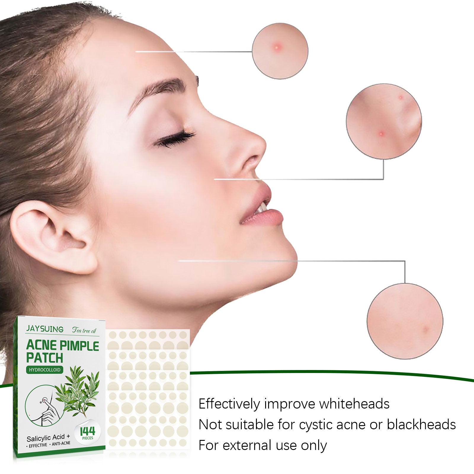 [vendor] Acne Pimple Patches, Hydrocolloid Acne Patches With Tea