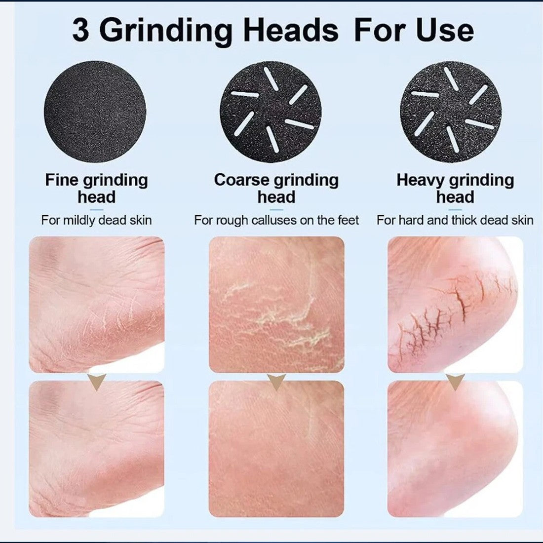 [vendor] Electric Foot File Waterproof Hard Skin Remover Feet