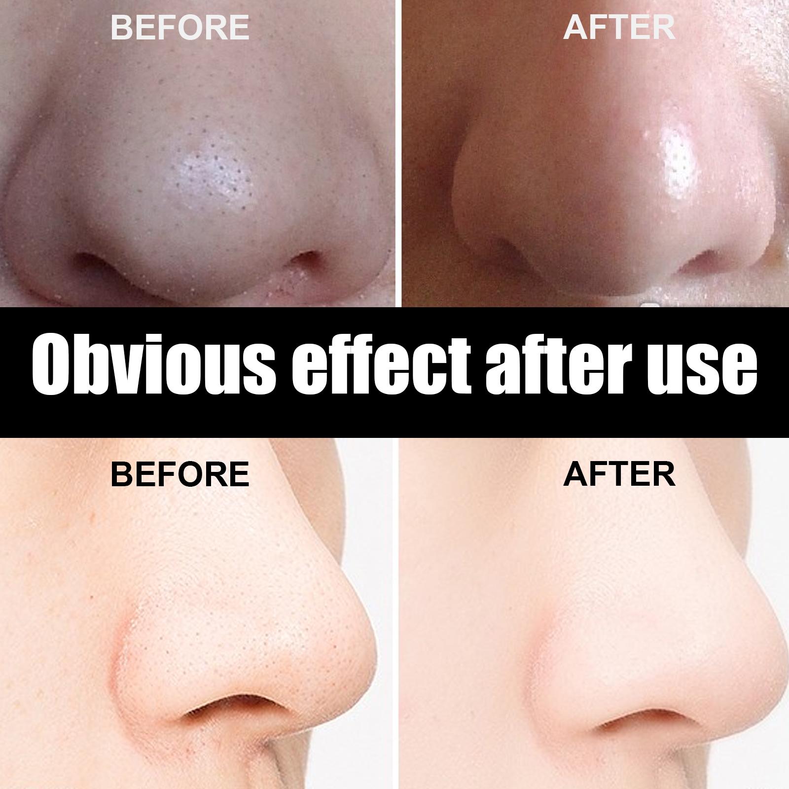 [vendor] 10 Pcs Blackhead Nose Patch Nose Pore Cleansing Strips