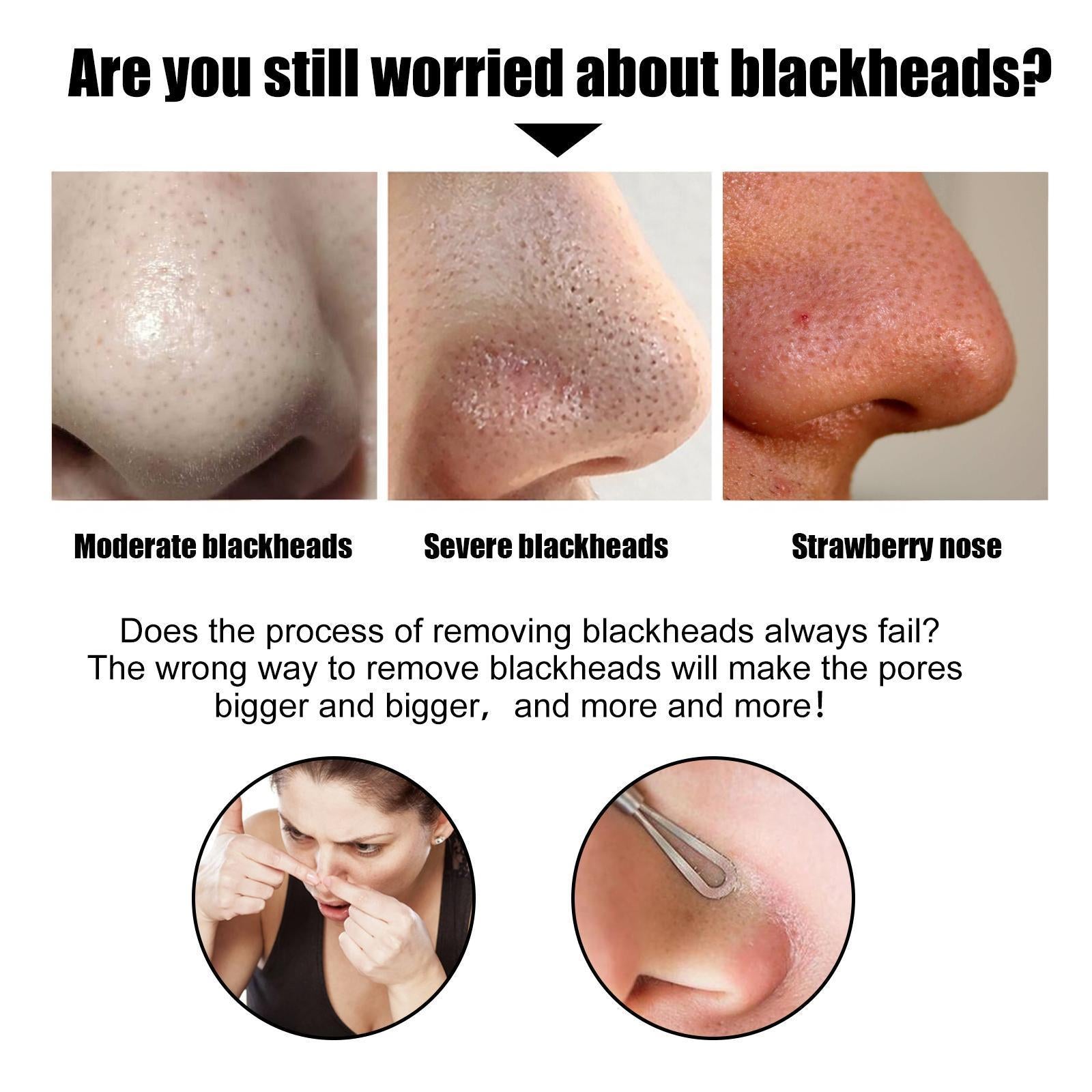 [vendor] 10 Pcs Blackhead Nose Patch Nose Pore Cleansing Strips