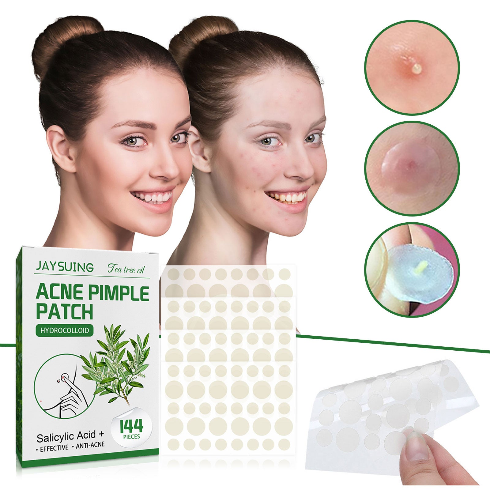 [vendor] Acne Pimple Patches, Hydrocolloid Acne Patches With Tea